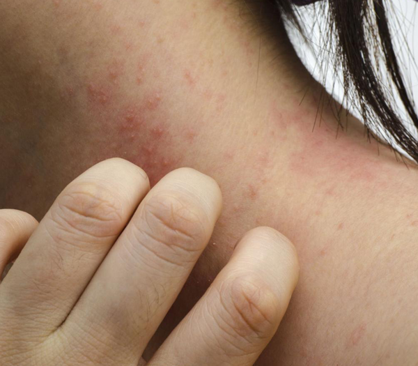 Patologie Dermatologiche